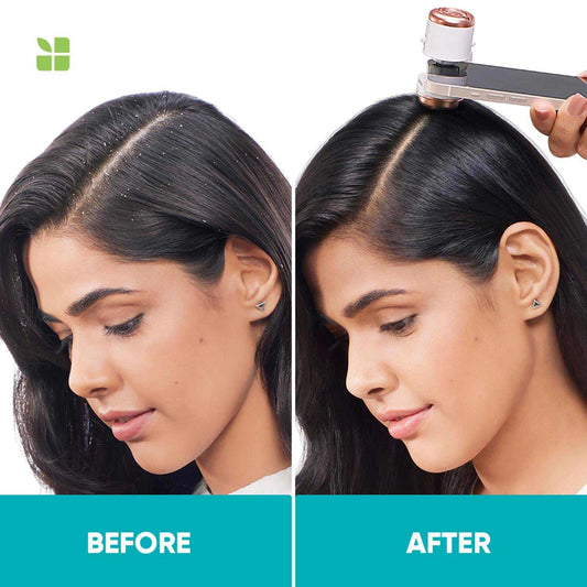 Matrix Biolage Advanced Scalppure Conditioner - 98 gm