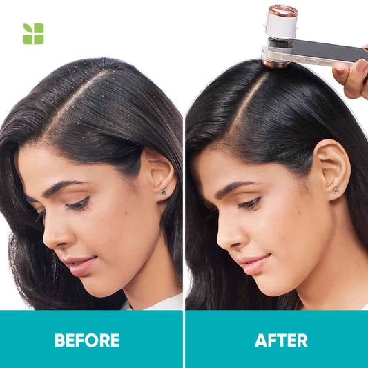 Matrix Biolage Advanced Scalppure Shampoo - 200 ml