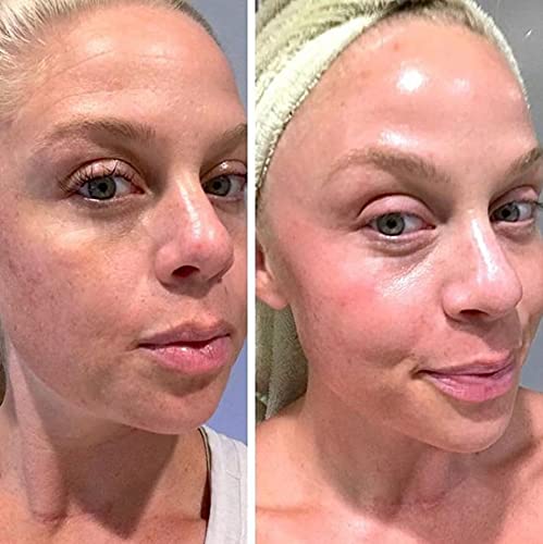Tretinoin Cream 0.05% | 20g Topical Prescription Medication