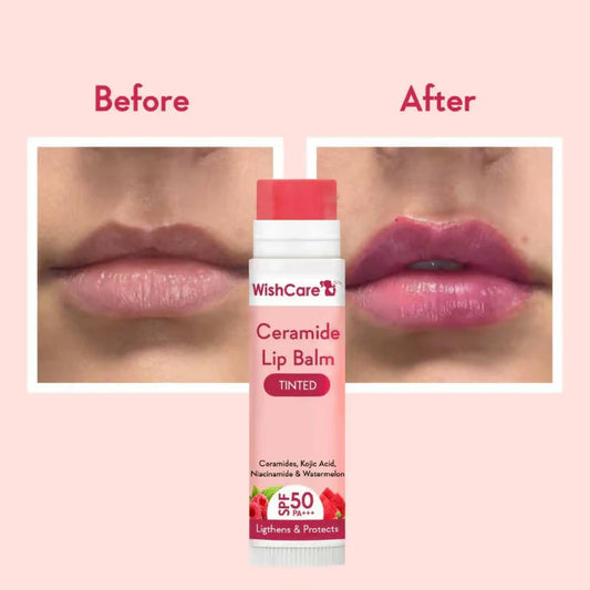 WishCare SPF 50 Lip Balm - Hydrating & Tinted Lip Care - 5g