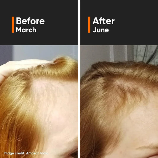 Minimalist Hair Growth Actives -30 ml