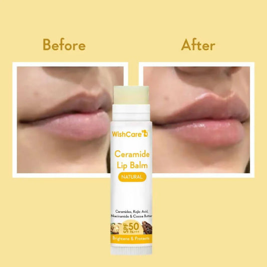 Hydrating Ceramide Lip Balm with SPF 50 – Untinted